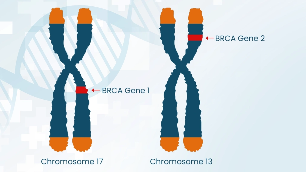 BRCA Gene