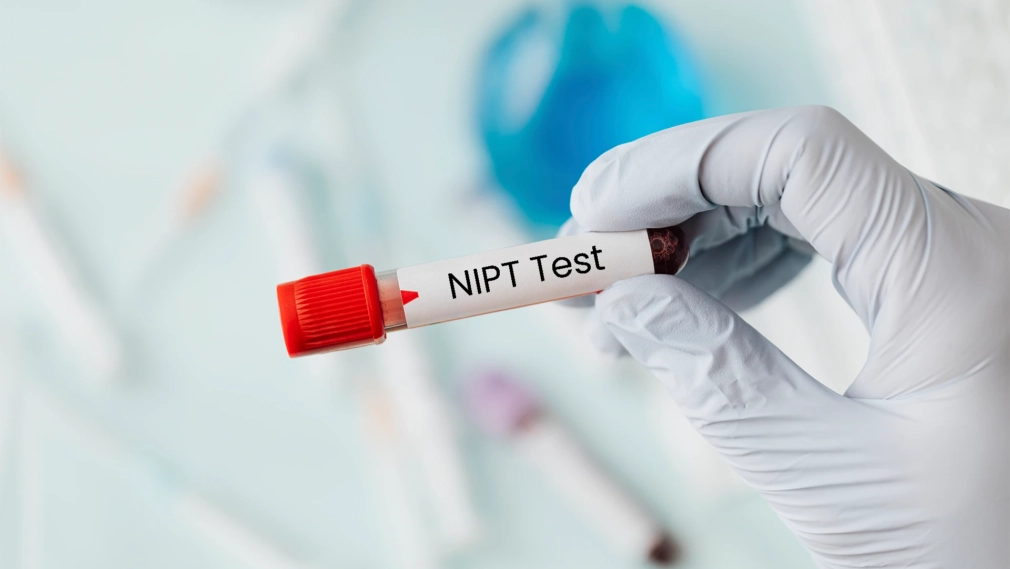 Unveiling the Mystery NIPT Test Cost